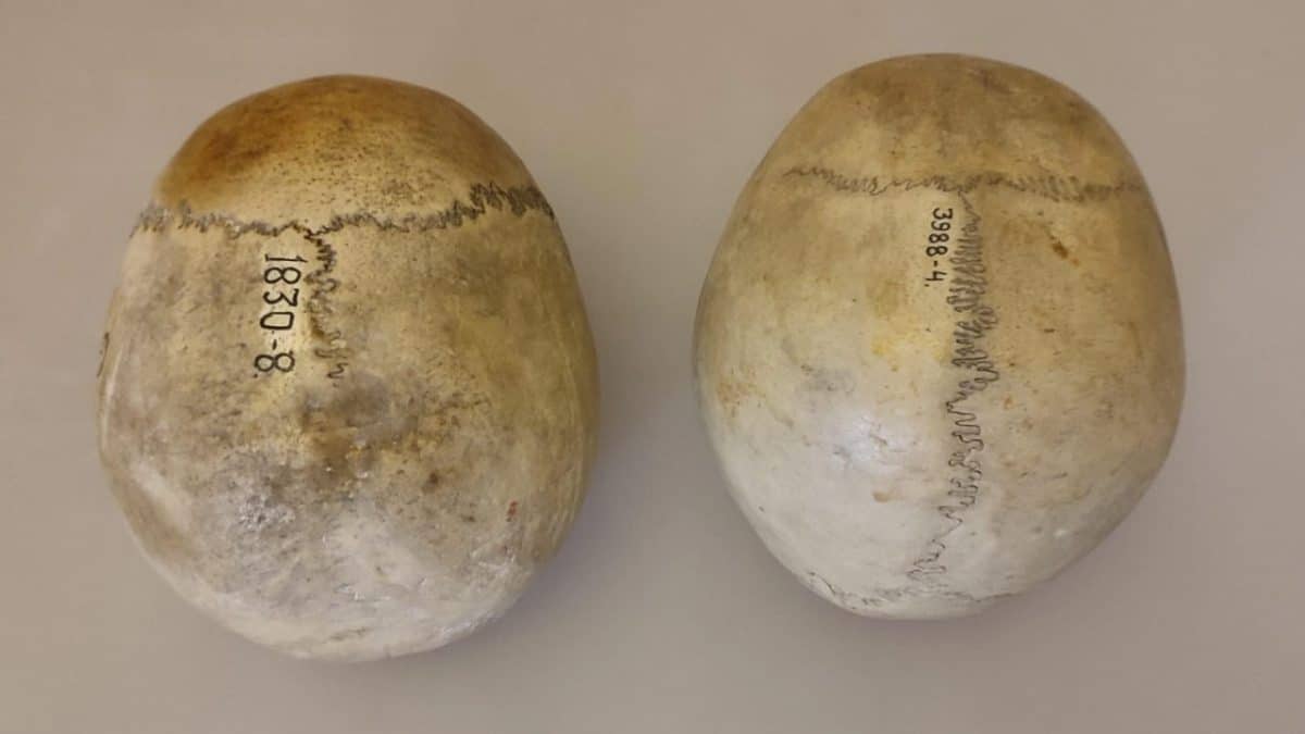 Российский ученый усовершенствовал оценку возраста по черепу