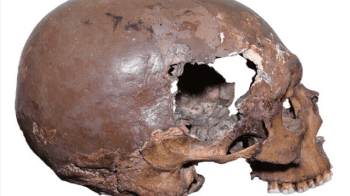 Антропологи нашли древнейшее свидетельство искусственной модификации черепа в Европе