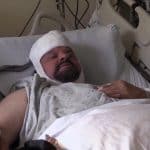 Врачи научились избавлять людей от невыносимой хронической боли электричеством