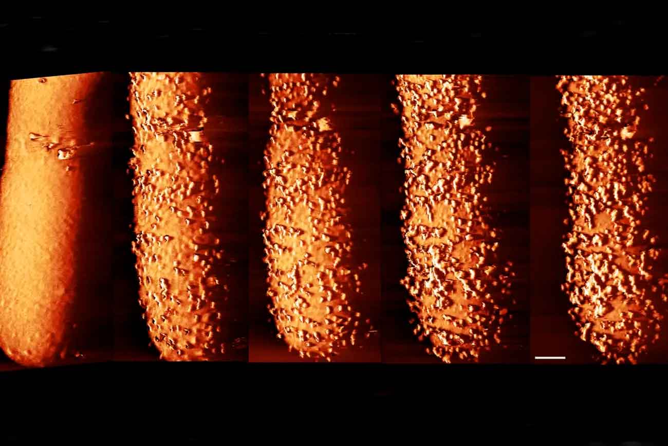E. coli