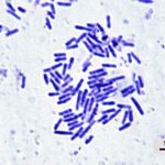 Резистентность бактерий: современные вызовы и перспективы