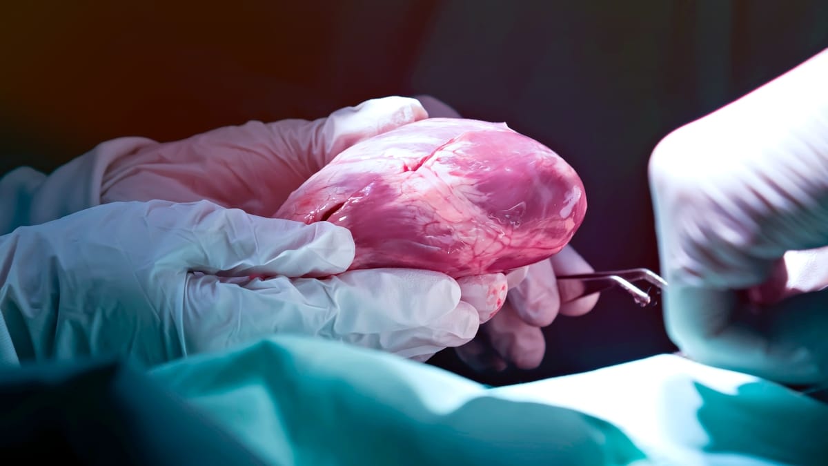 Хирурги проводят операцию по трансплантации сердца / © Kriangkrai Thitimakorn/Getty Images