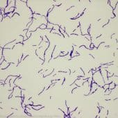 Капустная палочка Bacillus megaterium в увеличении 400x / © Marc Perkins