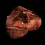 В России завершились доклинические испытания первого иммуноинженерного TRC-препарата против рака молочной железы