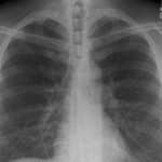 Что умеют легкие: факты о работе дыхательной системы человека