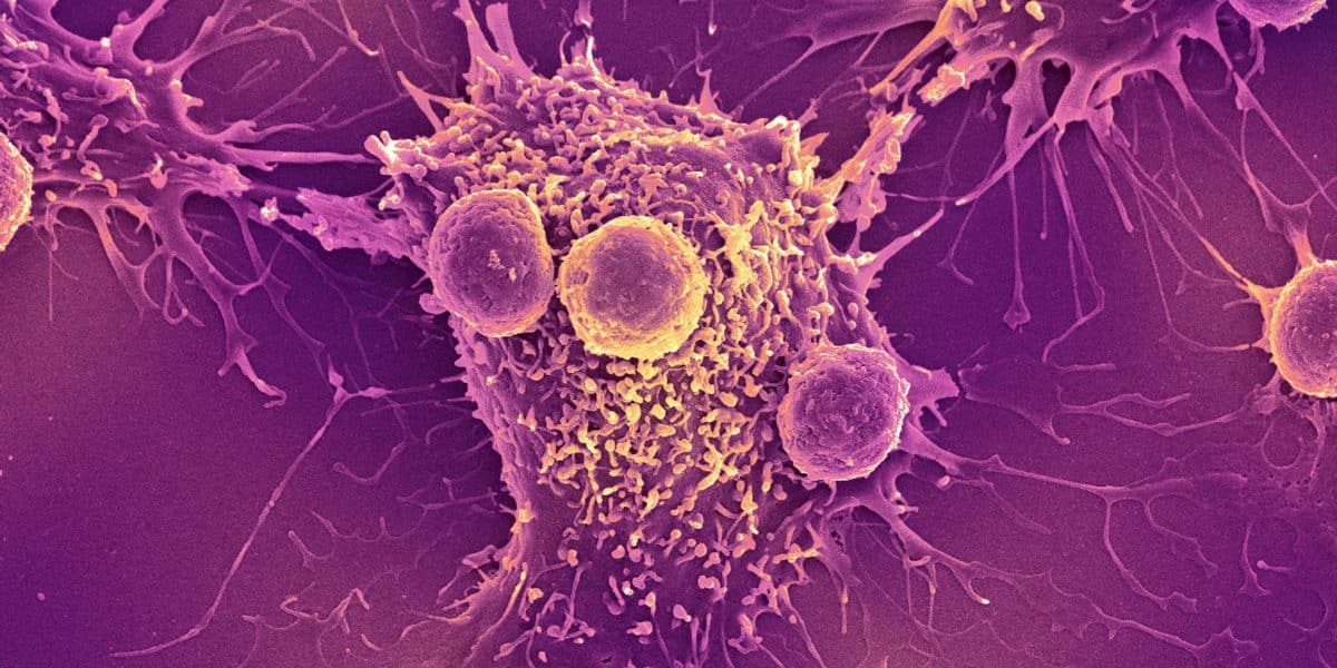 Т-лимфоциты атакуют раковую клетку (цветная сканирующая электронная микроскопия) / © Steve Gschmeissner / Science Photo Library / Getty Images