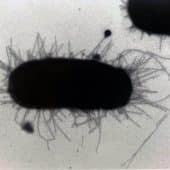 кишечная палочка