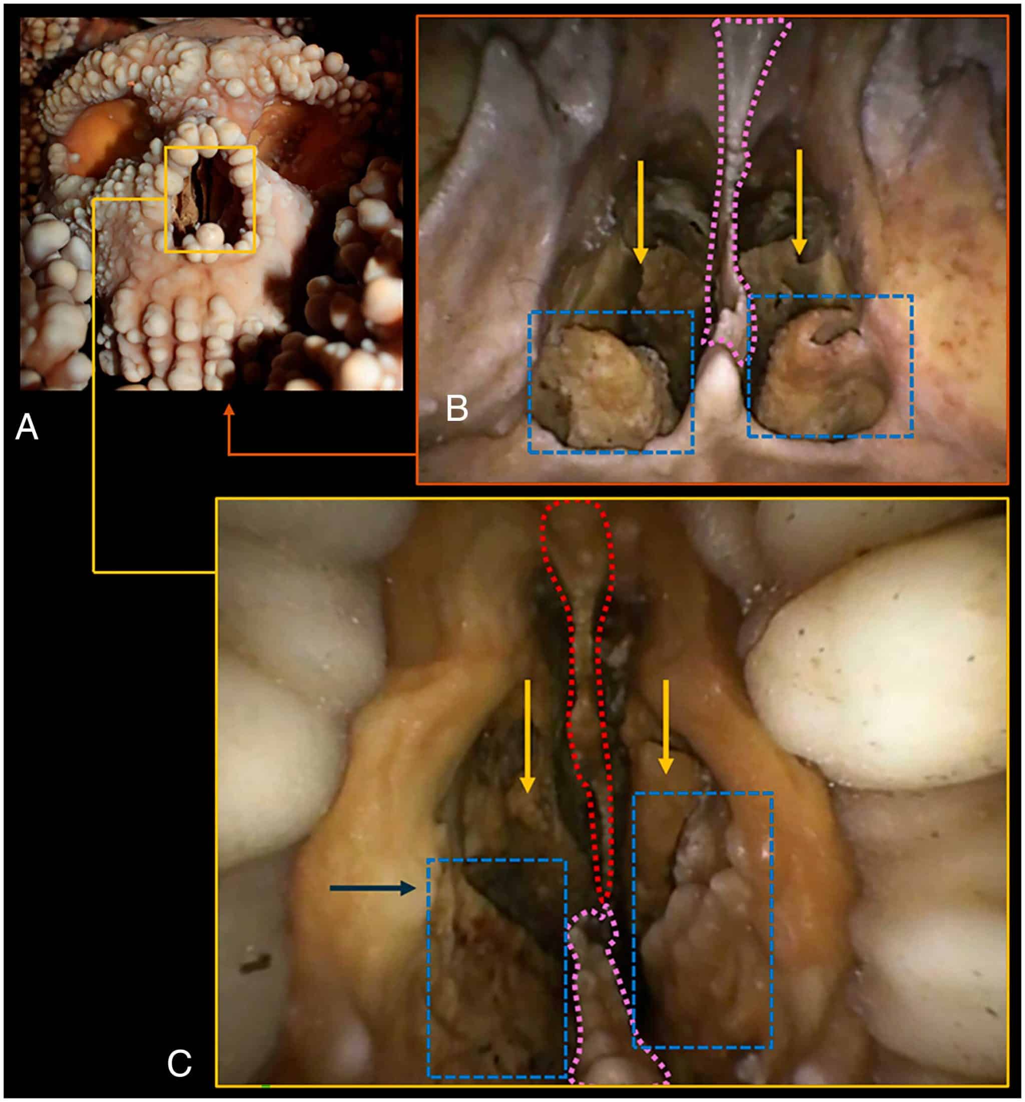 череп неандертальца
