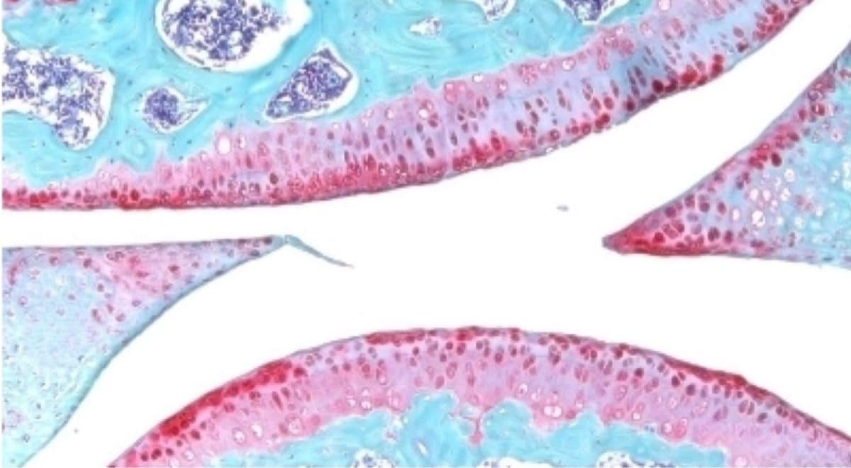 Коленный сустав пожилой мыши после введения препарата. Красный цвет указывает на хрящ / © Nidhi Bhutani, Science