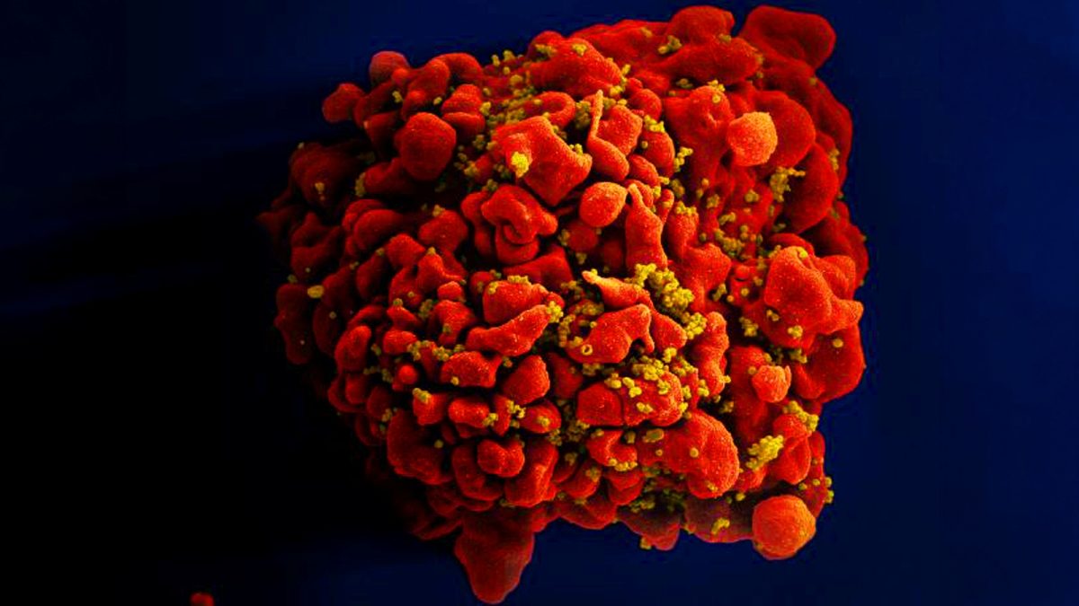 Химиотерапия позволила уничтожить скрытые резервуары ВИЧ