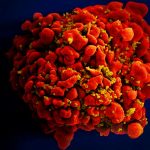 Химиотерапия позволила уничтожить скрытые резервуары ВИЧ