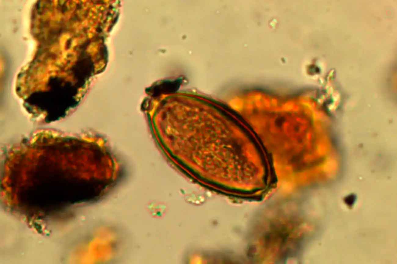 Яйцо власоглава