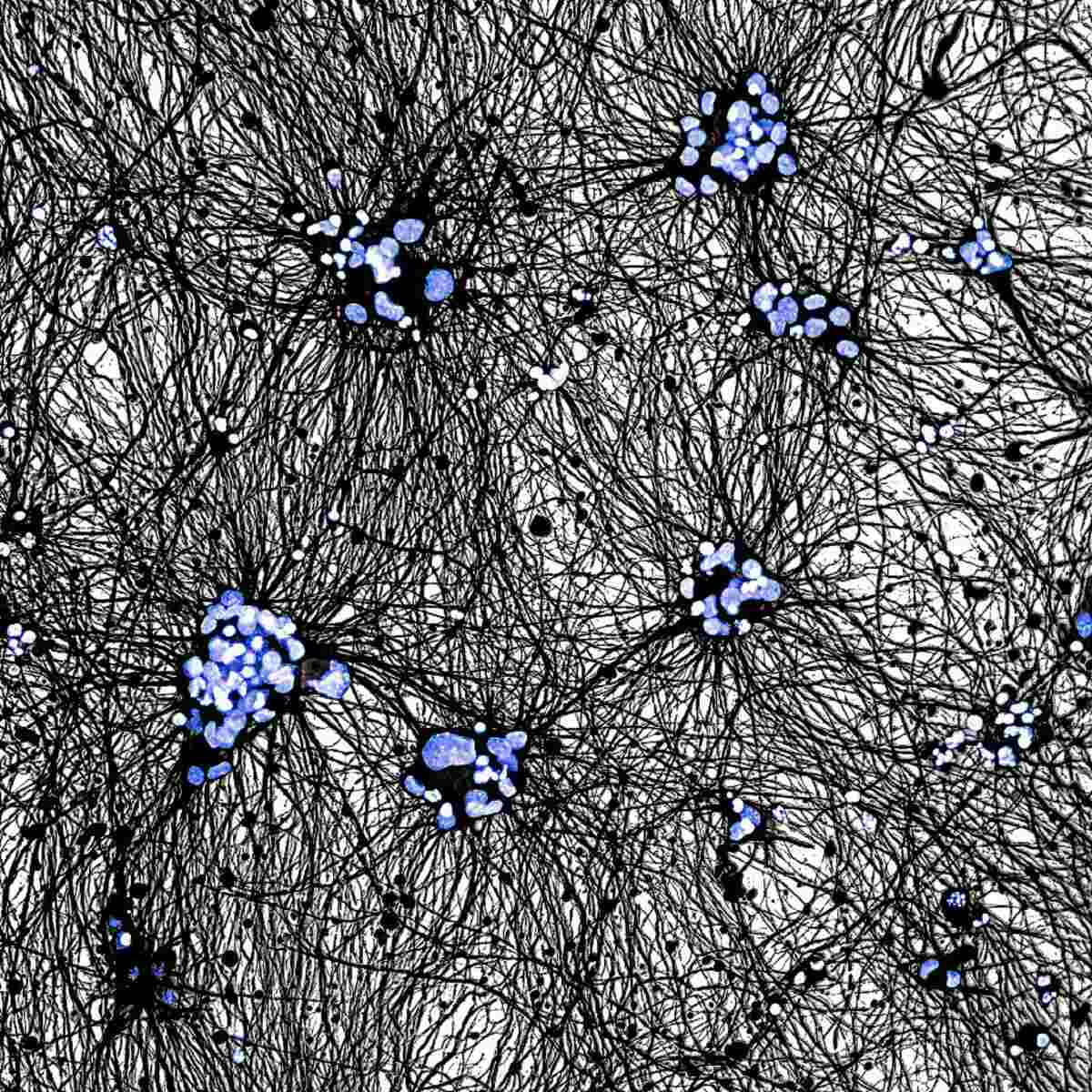 Работа финалиста в категории «Микрофотография» / © Swetha Gurumurthy