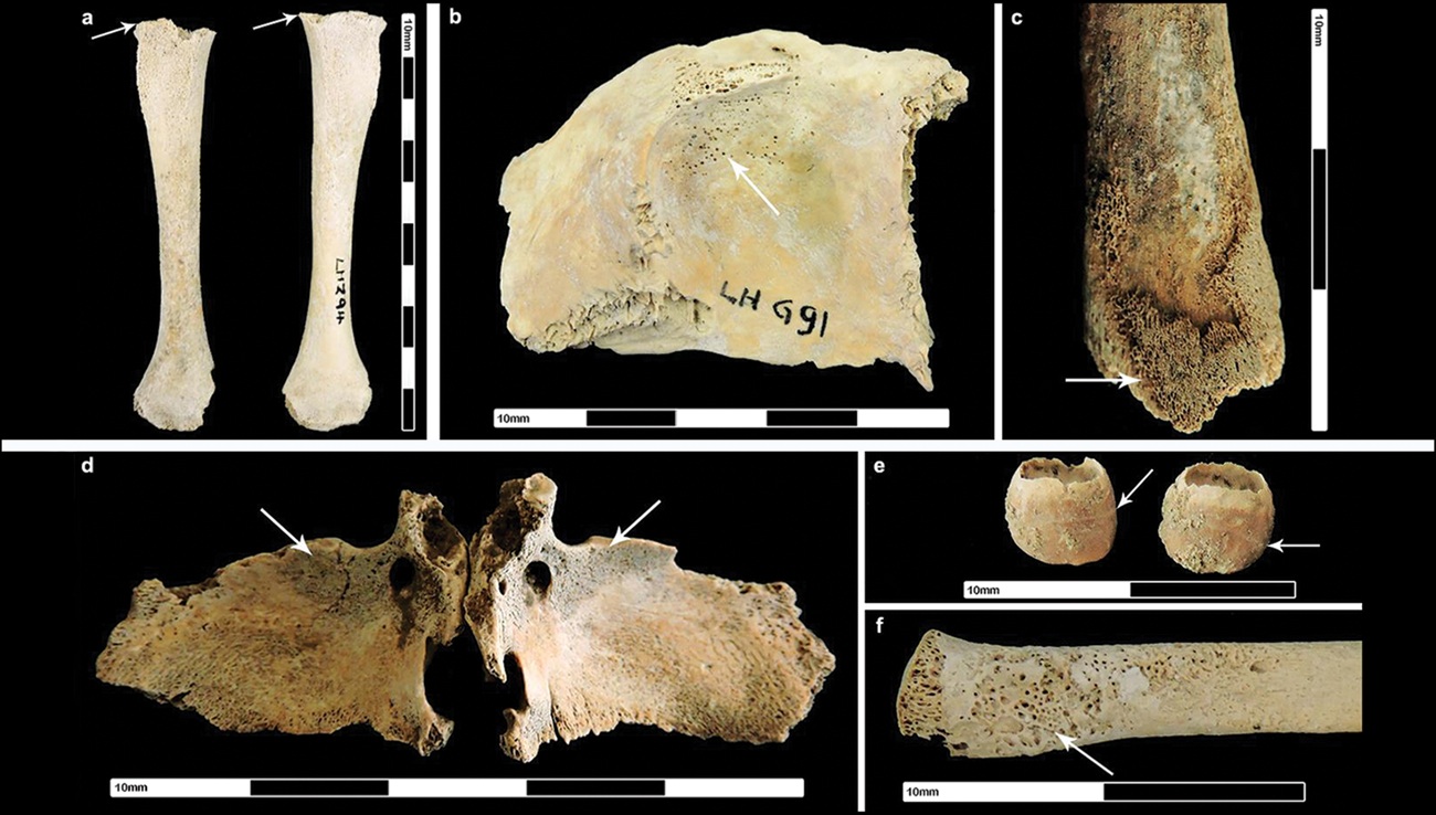 патологии ребенка