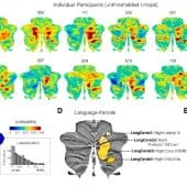 В мозжечке нашли область, которая отвечает исключительно за обработку речи
