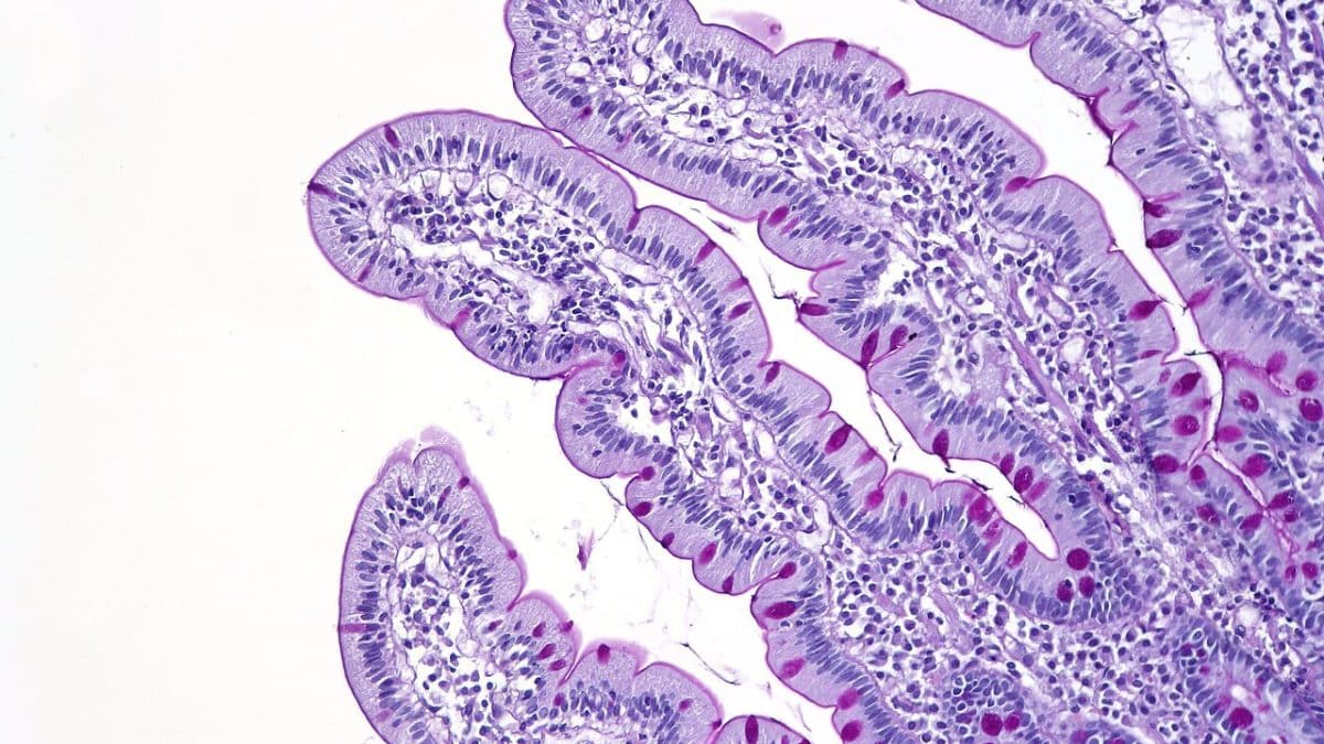 В кишечнике млекопитающих нашли древний антибиотик избирательного действия