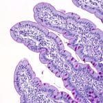 В кишечнике млекопитающих нашли древний антибиотик избирательного действия