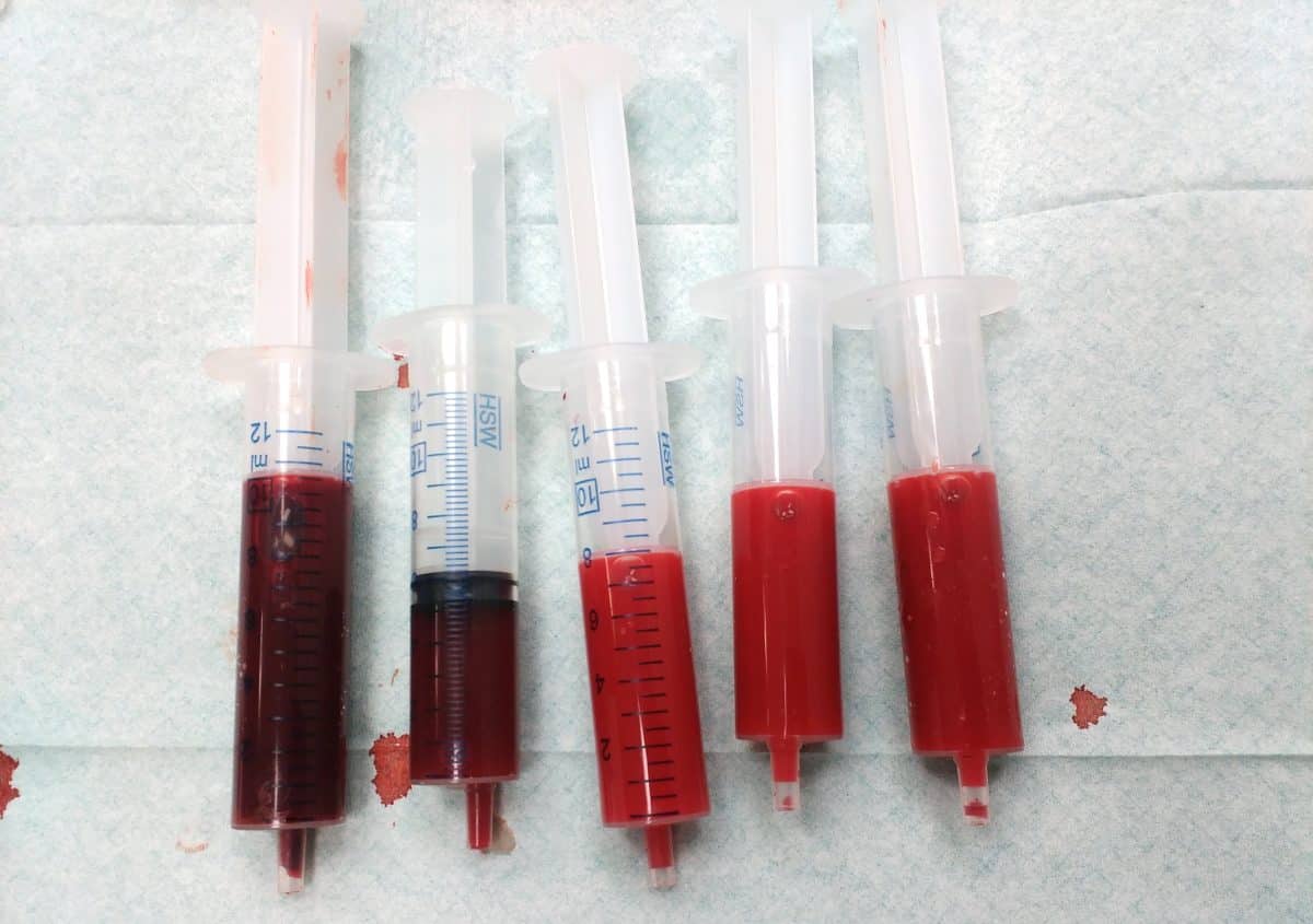 Кровь человека в шприц-пробирках / © Wesalius, Wikipedia