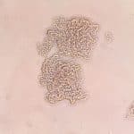 Туберкулезные палочки укрепили мембраны иммунных клеток, чтобы спрятаться внутри них