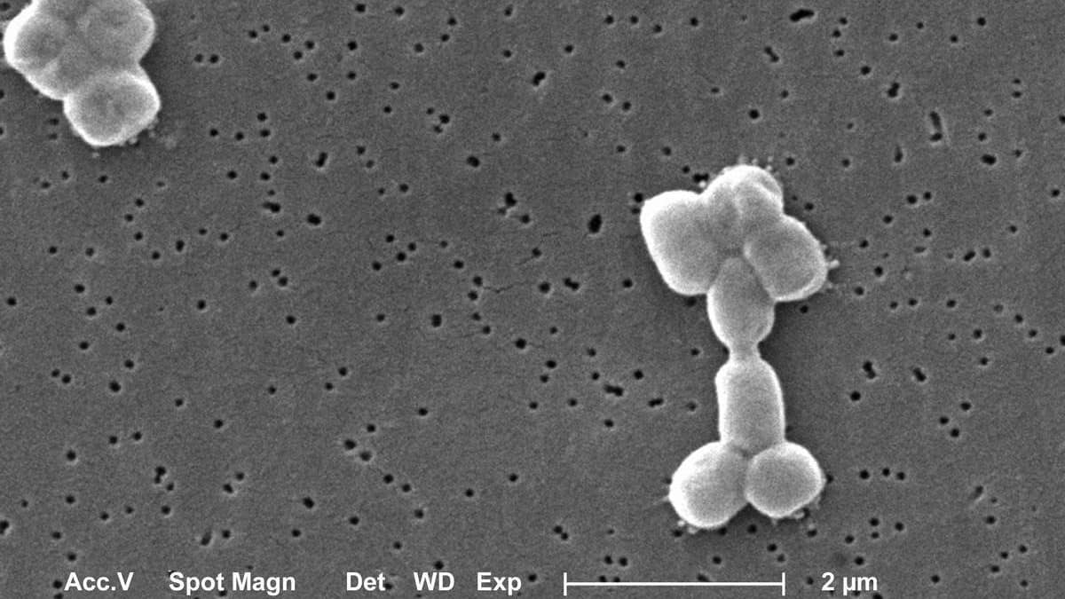 Устойчивые к антибиотикам бактерии выследили по их сахарам