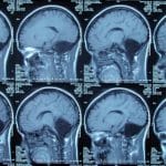 Чувство ритма. Нейробиология точности