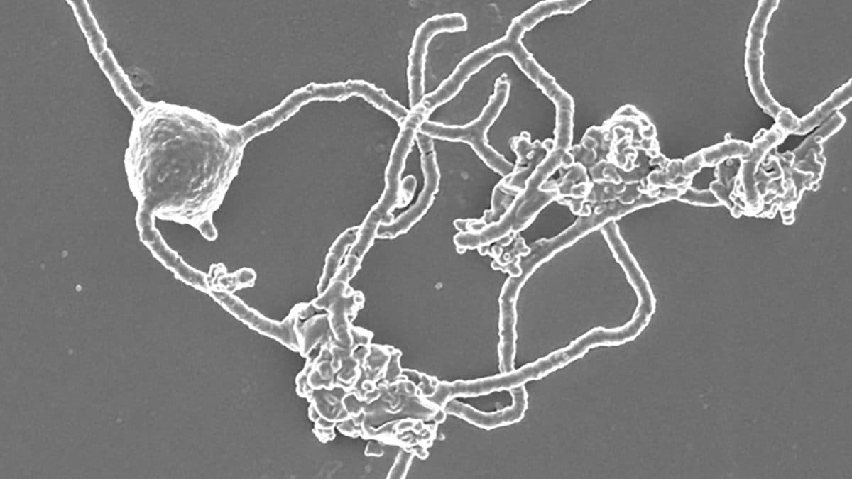 Древние предки эукариот научились дышать кислородом до симбиоза с бактериями