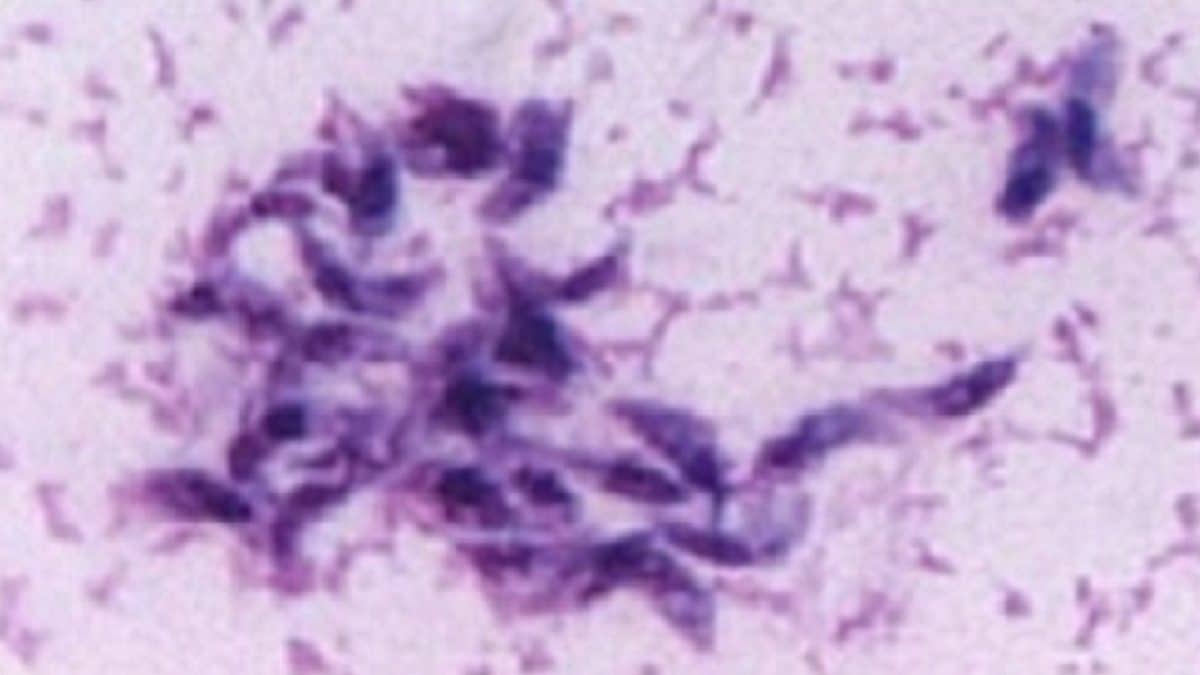 Болезнь Альцгеймера связали с токсоплазмой и вирусом герпеса