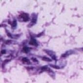 Токсоплазма под электронным микроскопом