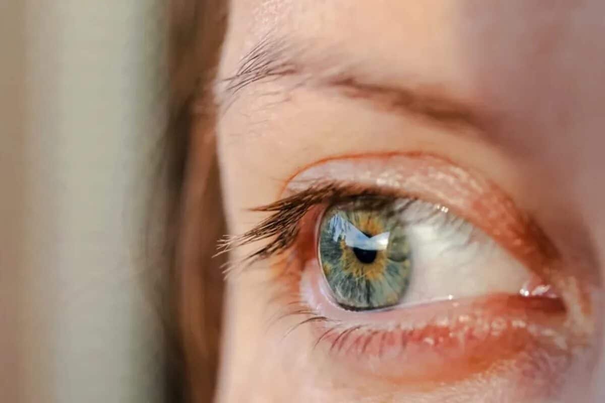 Синдром сухого глаза стал предвестником аутоиммунных заболеваний