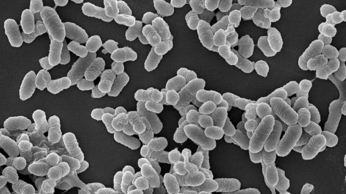 Две бактерии-комменсала сообща разрушили защитную слизистую стенку кишечника и вызвали хронический запор у мышей