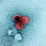 Ученые нашли новые подтверждения связи вируса Эпштейна — Барр с рассеянным склерозом