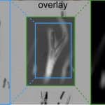 Магнитно-частичную томографию впервые опробовали на человеке