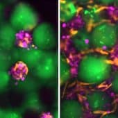 Новый препарат для инъекций содержит клетки печени (фиолетовые), микросферы гидрогеля (зеленые) и поддерживающие клетки фибробласты (оранжевые)