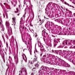 Российские ученые обучили ИИ отличать опасные и безвредные мутации в генах, связанных с болезнями сердца