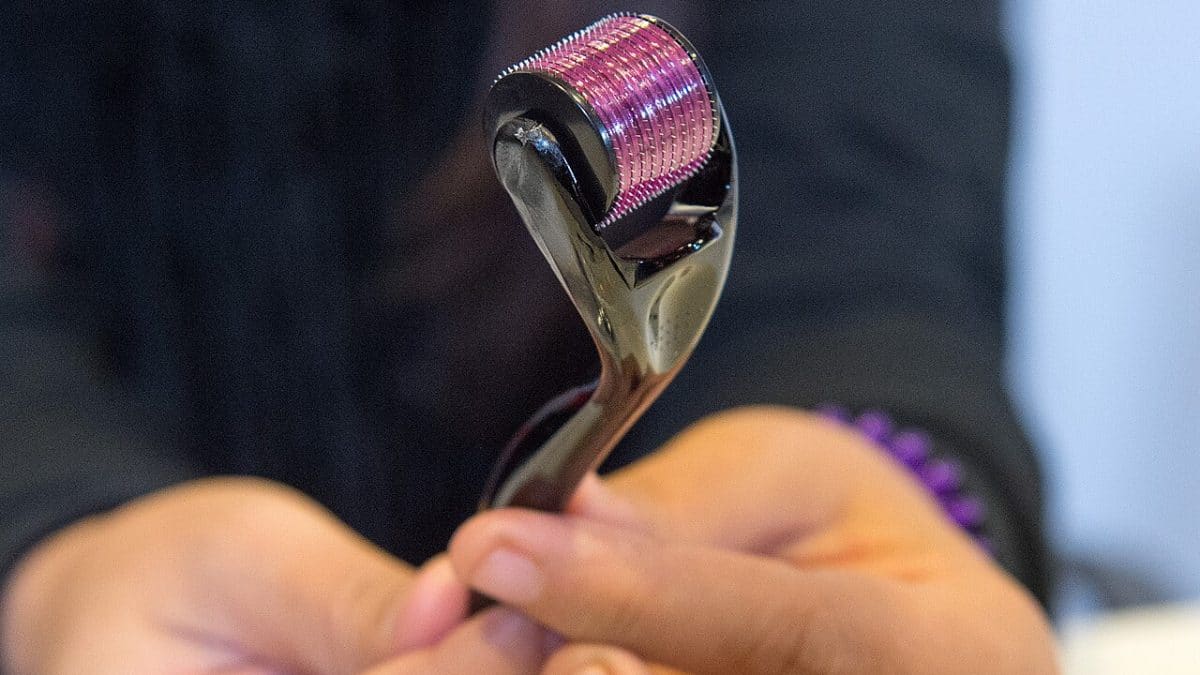 وأوضح الطبيب مخاطر الميزوسكوتر المنزلي