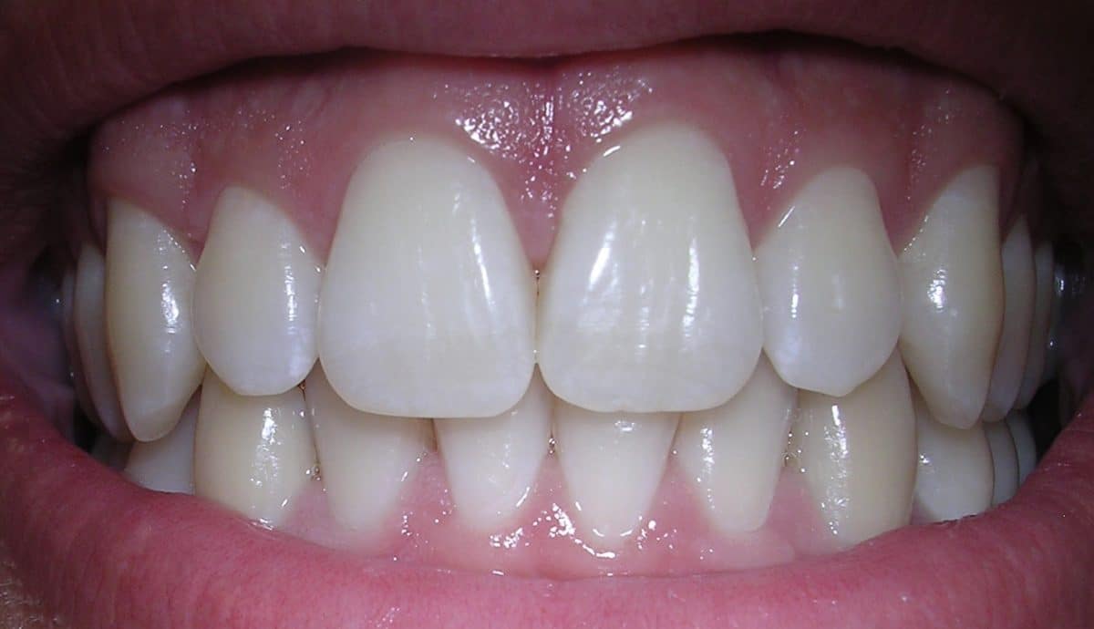 © Dozenist, Wikipedia