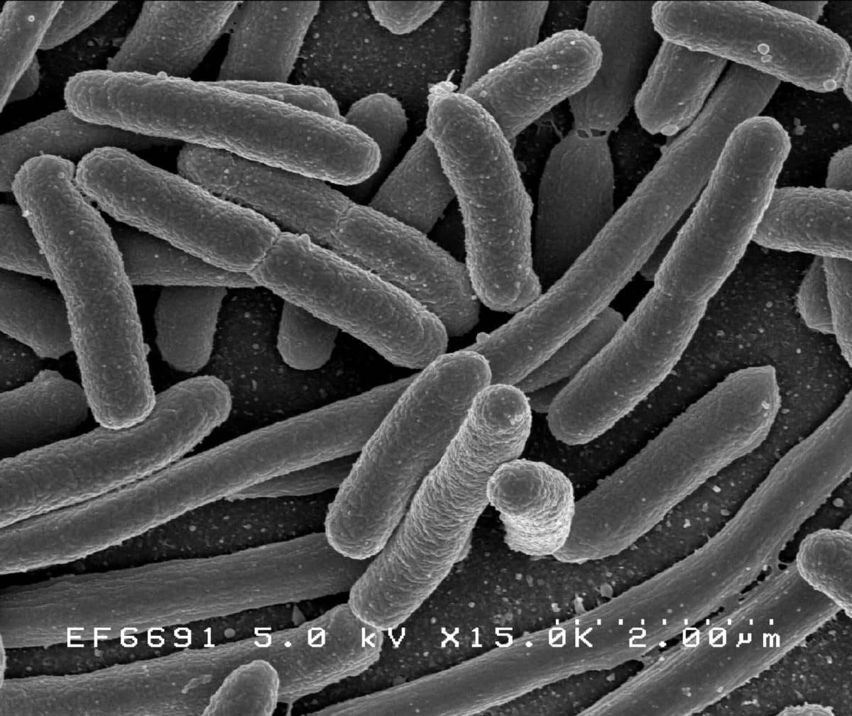 Escherichia col