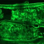 Мицелий в клетках корня Lotus japonicus / © Science Advances (2026). DOI: 10.1126/sciadv.aec5607