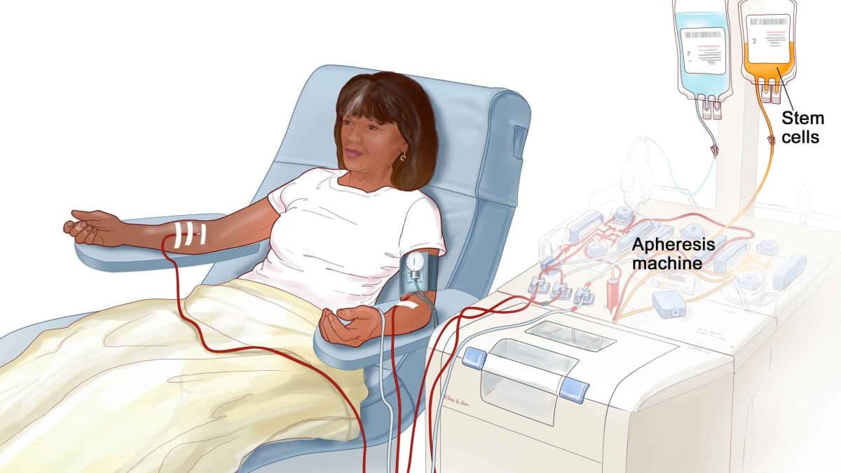 Medical apheresis machine with tubing and blood bags in a clinical setting