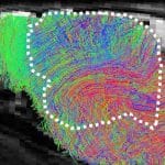 Биологи заменили кору мозга мышей на человеческую, чтобы изучать неврологические болезни