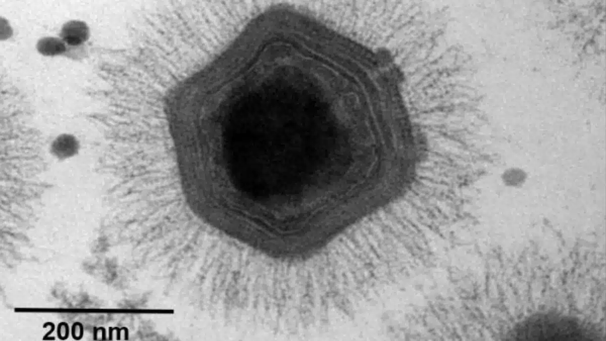Представитель группы Nucleocytoviricota под электронным микроскопом
