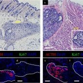 подкожная ткань