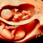 Ученые описали редкий клинический случай внутриутробного распространения рака между близнецами