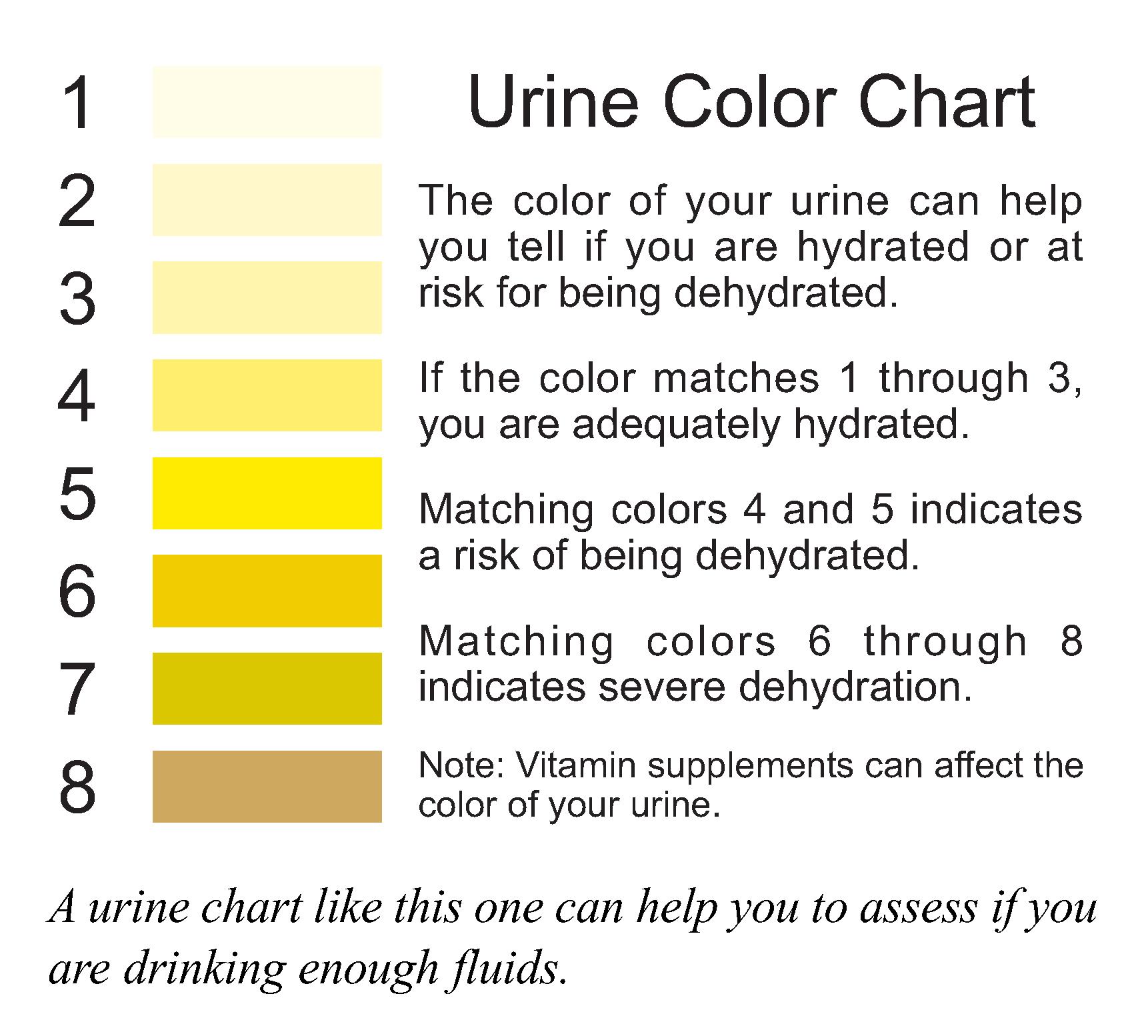 Не отходит моча у мужчины. Urine Color Chart. Urine Color Chart на русском. Urine Chart. Urine RS шкала'.